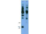 Cyclin D3 Antibody in Immunoprecipitation (IP)