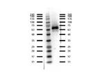 Abi1 Antibody in Western Blot (WB)