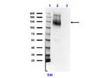 Ire1 Antibody in Western Blot (WB)