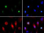 H3K4acT3ph Antibody in Immunocytochemistry (ICC/IF)