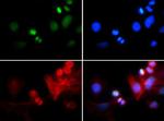 H3K4me3T6ph Antibody in Immunocytochemistry (ICC/IF)