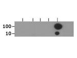 H3K18ac Antibody in Dot Blot (DB)