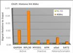 H4K8ac Antibody in ChIP Assay (ChIP)