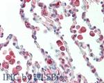 Protein Kinase C delta-Binding Protein Antibody in Immunohistochemistry (Paraffin) (IHC (P))