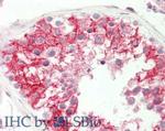 STIM1 Antibody in Immunohistochemistry (Paraffin) (IHC (P))