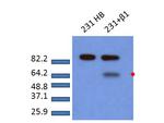 Phospho-SMAD2 (Ser465, Ser467) Antibody in Western Blot (WB)