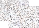 Smoothened Antibody in Immunohistochemistry (IHC)