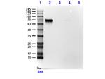 SLC40A1 Antibody in Western Blot (WB)