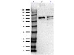 SLC40A1 Antibody in Western Blot (WB)