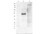 beta 1 Adrenergic Receptor Antibody in Western Blot (WB)