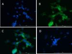 MMP2 Antibody in Immunocytochemistry (ICC/IF)