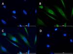 TBK1 Antibody in Immunocytochemistry (ICC/IF)