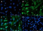 VAChT Antibody in Immunocytochemistry (ICC/IF)