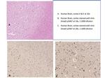 Phospho-SMAD2 (Ser467) Antibody in Immunohistochemistry (IHC)