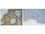 Collagen Type I Antibody in Immunohistochemistry (Paraffin) (IHC (P))