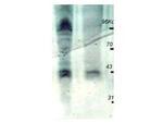 Phosphothreonine Antibody in Western Blot (WB)