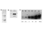 Lysine Acetylated Antibody in Western Blot (WB)