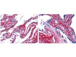 Collagen Type V Antibody in Immunohistochemistry (Paraffin) (IHC (P))
