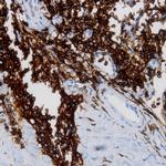 TAFA2 Antibody in Immunohistochemistry (Paraffin) (IHC (P))