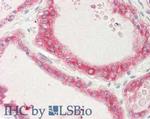 STIM1 Antibody in Immunohistochemistry (Paraffin) (IHC (P))