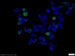MYC tag Antibody in Immunocytochemistry (ICC/IF)