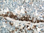 TGFBI / BIGH3 Antibody in Immunohistochemistry (Paraffin) (IHC (P))