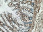 TGFBI / BIGH3 Antibody in Immunohistochemistry (Paraffin) (IHC (P))