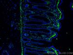 TGFBI / BIGH3 Antibody in Immunohistochemistry (PFA fixed) (IHC (PFA))