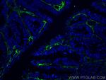 TGFBI / BIGH3 Antibody in Immunohistochemistry (PFA fixed) (IHC (PFA))