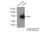 TGFBI / BIGH3 Antibody in Immunoprecipitation (IP)