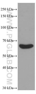 TGFBI / BIGH3 Antibody in Western Blot (WB)