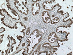 S100A11 Antibody in Immunohistochemistry (Paraffin) (IHC (P))