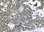 S100A11 Antibody in Immunohistochemistry (Paraffin) (IHC (P))