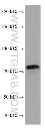 KEAP1 Antibody in Western Blot (WB)