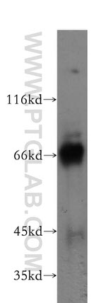 KEAP1 Antibody in Western Blot (WB)