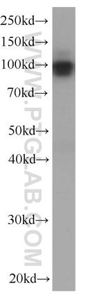 MME/CD10 Antibody in Western Blot (WB)