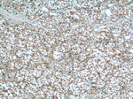 MME/CD10 Antibody in Immunohistochemistry (Paraffin) (IHC (P))