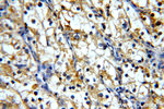 MME/CD10 Antibody in Immunohistochemistry (Paraffin) (IHC (P))