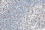 CXCR4 Antibody in Immunohistochemistry (Paraffin) (IHC (P))