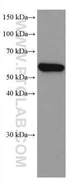 CXCR4 Antibody in Western Blot (WB)