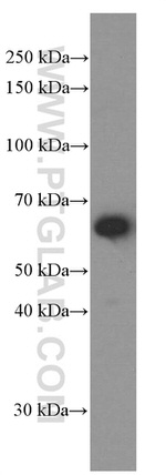 CXCR4 Antibody in Western Blot (WB)