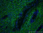 EMILIN1 Antibody in Immunohistochemistry (PFA fixed) (IHC (PFA))