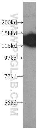 EMILIN1 Antibody in Western Blot (WB)