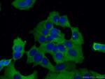 Annexin A2 Antibody in Immunocytochemistry (ICC/IF)