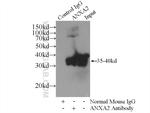 Annexin A2 Antibody in Immunoprecipitation (IP)