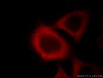 Annexin A2 Antibody in Immunocytochemistry (ICC/IF)