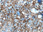 MAGEA3 Antibody in Immunohistochemistry (Paraffin) (IHC (P))