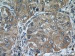 MAGEA3 Antibody in Immunohistochemistry (Paraffin) (IHC (P))