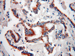 MAGEA3 Antibody in Immunohistochemistry (Paraffin) (IHC (P))