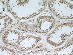 MAGEA3 Antibody in Immunohistochemistry (Paraffin) (IHC (P))